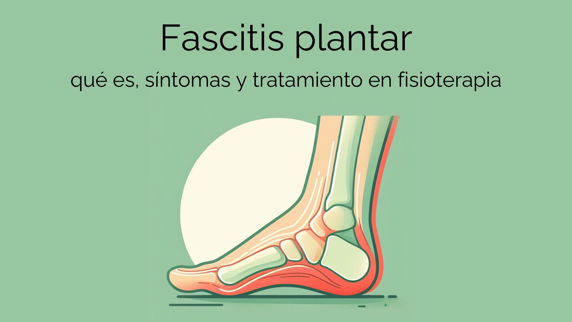 Fascitis plantar: síntomas, diagnostico y tratamiento. CUN